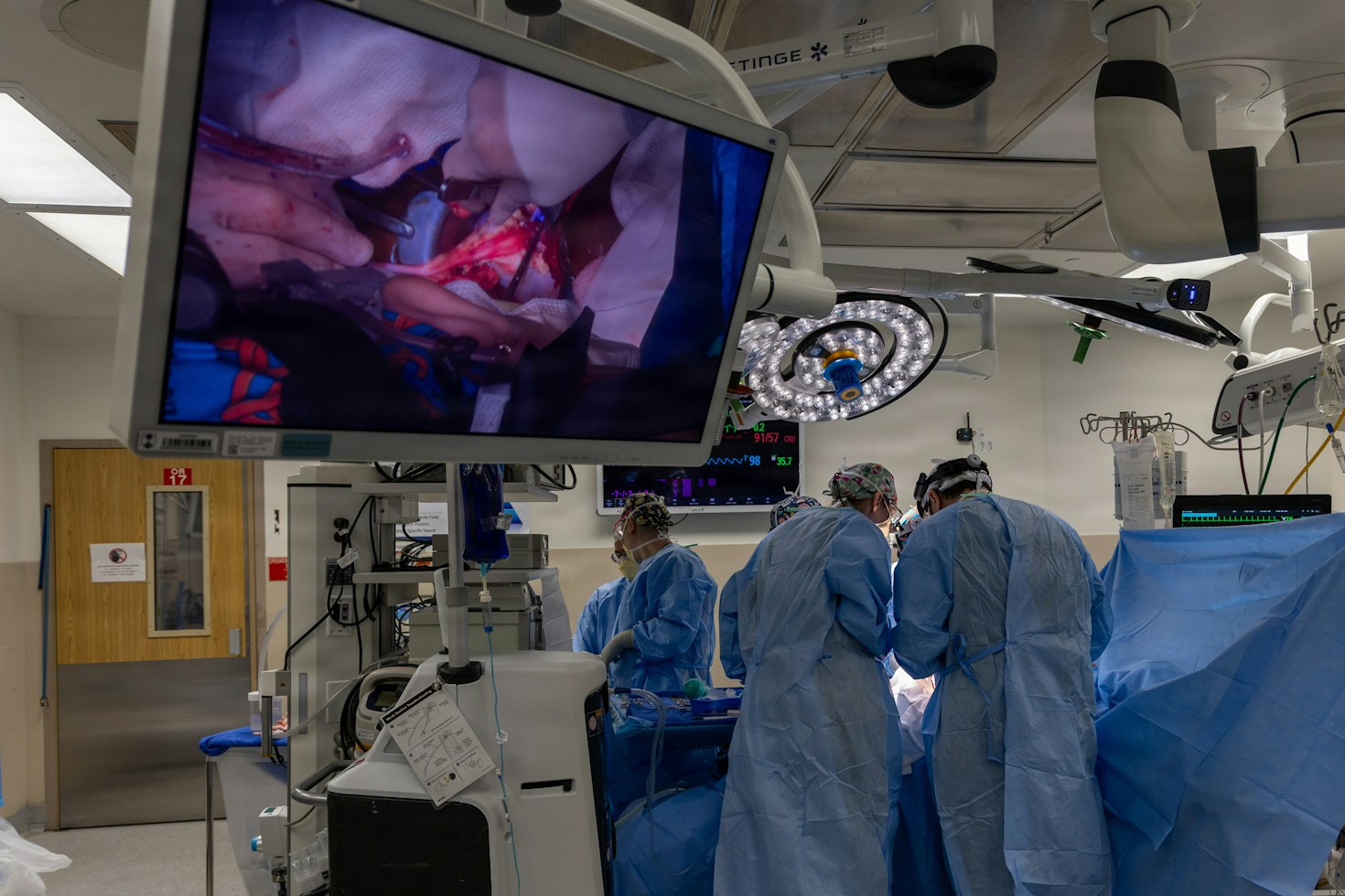 Innovations in Pediatric Neurosurgical Care Around the World